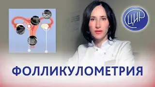 Фолликулометрия: что такое фолликулометрия и когда делается фолликулометрия. Магнитская Н.А.