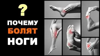 +   3 основных причины болей в ногах  Почему болят ноги и стопы