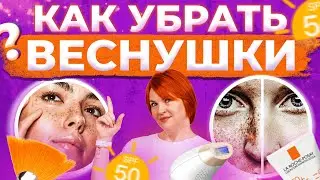 Как убрать веснушки? Что рекомендует косметолог Доктор Кобец?