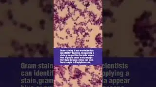 Gram positive cocci in clusters under the microscope 