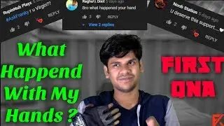 #1 QnA Video | My Gaming career with one finger | Rapid Fire and More #QnA #FrankIsLIve