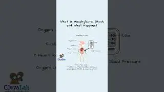 What is anaphylactic shock and what happens? #shorts