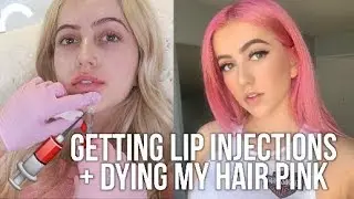 GETTING LIP INJECTIONS + DYING MY HAIR PINK ♡