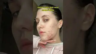 Пока что без рецидивов ✨