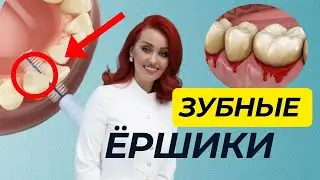 Зубные ёршики: как правильно использовать, кому они необходимы?