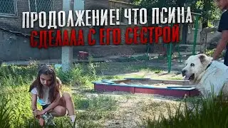 ПРОДОЛЖЕНИЕ! СЕСТРУ МАКСА ВАЩЕНКО УКУСИЛА СОБАКА