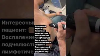 Интересный пациент.
