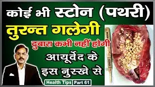 Kidney Stone Gallstone Problem | पथरी कहीं की भी हो तुरन्त गलेगी बिना आपरेशन 100% कामयाब नुस्खा