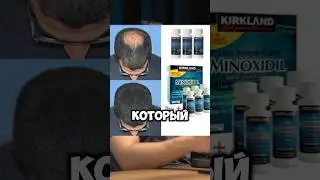 ВАРГУНИН ПРО ОБЛЫСЕНИЕ #гормоны #интервью