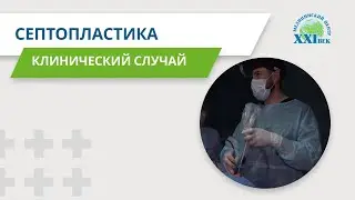 Исправление искривленной перегородки носа 😷 Септопластика