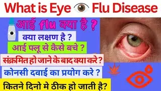 Eye Flu  Kya hai Eye Flu ke Laxshn kya hai, Eyu flu hone ke bad Kya kre, Eye Flu se kaise bache