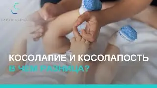 Косолапость и косолапие — есть ли разница?