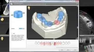 coDiagnostiX 9: Digital Workflow