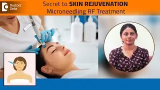 Get rid of ACNE SCARS|What is Microneedling RF (MNRF)Treatment?-Dr.Mariet Zacharias| Doctors Circle