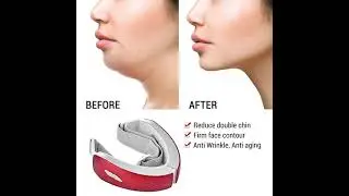 A2013 V Shape Face Lifting Device