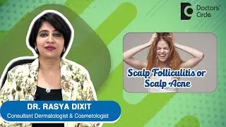 ACNE OR PIMPLES ON SCALP | Scalp Folliculitis - Causes & Treatment- Dr.Rasya Dixit | Doctors' Circle