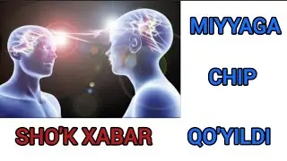 SHO'K XABAR. INSON MIYYASIGA CHIP QO'YILDI.ЧИП ВСТАВЛЕН В МОЗГ ЧЕЛОВЕКА.
