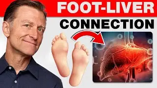 How Your Feet Are Warning You About Your Liver Problems - Dr. Berg Explains