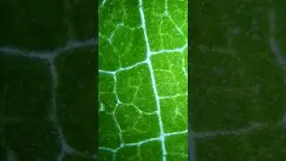 Stinging Nettles In A Microscope