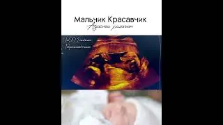 МАЛУМОТ УЧУН ФАКАТ ТЕЛЕГРАМДАН ЁЗИНГ: +998950014004 #Узи #беременность #гинекология #Хомиладорлик