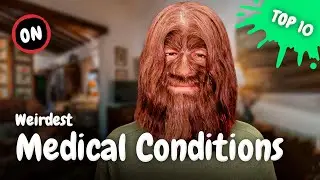 10 Weirdest Medical Conditions