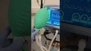 Ventilasyon Cihazı Akciğerleri Böyle Şişiriyor 