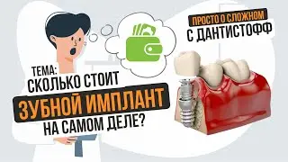 Сколько стоит зубной имплант? → Просто о сложном с Дантистофф 