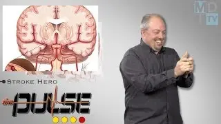 The Pulse: Powering Implants with the Heart & Playing Stroke Hero