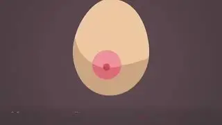 Кукрак саратони белгилари