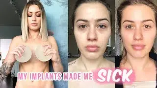 The TRUTH about BREAST IMPLANTS - Breast Implant Illness | Karissa Pukas