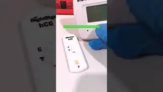 Live Pregnancy Testing #laboratory #medtechstudent #cls #mls #hcgtest #pregnancytest