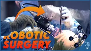 How robots replace knees - Robotic knee surgery