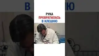 Рука Превратилась в Клешню..