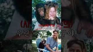 친구가 키우던 침팬지에게 공격당한 여성