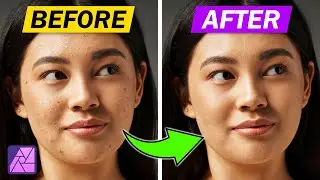 Basic Face Touch-Up in Affinity Photo