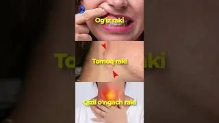 Chekishni tashlagandan keyin Sizda bu o'zgarishlar bo'ladi!