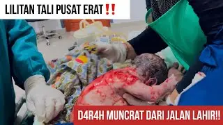 BAYI LILITAN TALI PUSAT ERAT‼️KELUAR D4R4H DARI JALAN LAHIR‼️