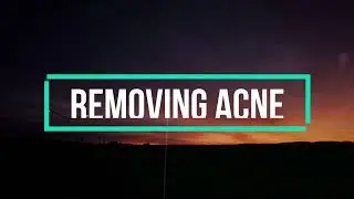 How to removed Acne in Photoshop/TABILI TV