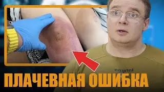 ЭТА ОШИБКА чуть НЕ УБИЛА КОЛЕНО | Не Делай Так