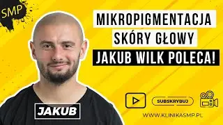 MIKROPIGMENTACJA SKÓRY GŁOWY - JAKUB WILK Poleca zabieg w KLINICE SMP!