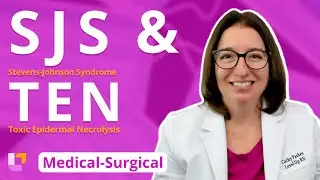 (SJS) Stevens-Johnson Syndrome & (TEN) Toxic Epidermal Necrolysis -Medical-Surgical | 