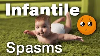 Recognizing Infantile Spasms: Pediatrician’s Tips | AAP 