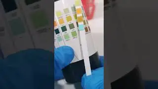 Urine reagent strips testing #laboratory #mls #cls #medtechstudent