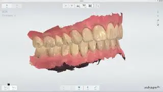 3Shape TRIOS 3 3D ve Renk Kalibrasyonu -  3D and Color Calibration