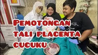 Pemotongan tali placenta cucuku