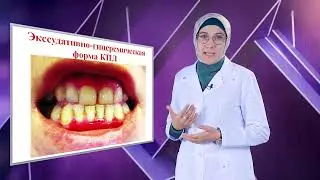 Красный плоский лишай полости рта: клиника, диагностика, лечение