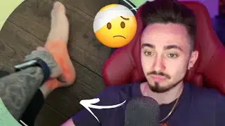 🤕ЭДИСОН СЛОМАЛ НОГУ!