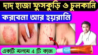 Fungal infection in private parts  | দাদ হাজা চুলকানির থেকে মুক্তির উপায় | Antifungal cream