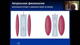 ЗАБОЛЕВАНИЯ ВЕН НИЖНЕЙ КОНЕЧНОСТИ