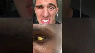 HIS EYEBALL IS GOLD 😳